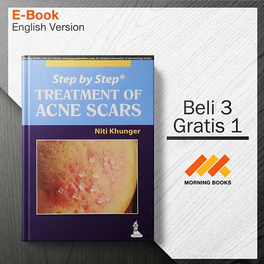 Step By Step Treatment Of Acne Scars – Morning Store