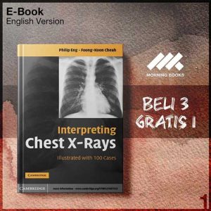 Cambridge_Interpreting_Chest_X_Rays_Illustrated_with_100_Cases-Seri-2f.jpg