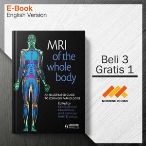 MRI_of_the_Whole_Body-_An_Illustrated_Guide_to_Common_Pathologies_000001-Seri-2d.jpg