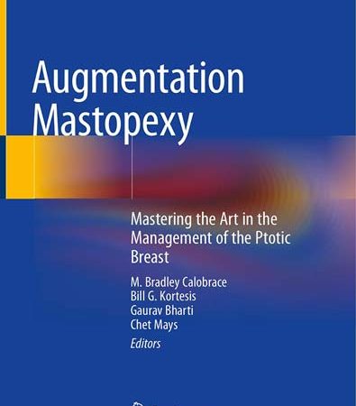 Augmentation_Mastopexy_Mastering_the_Art_in_the_Management_of_the_Ptotic_Breast.jpg