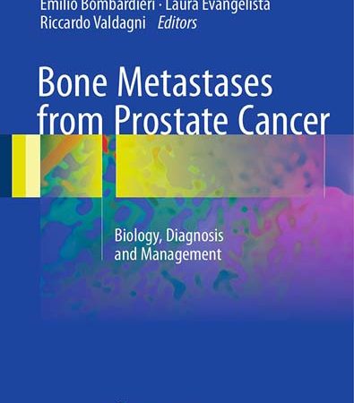 Bone_Metastases_from_Prostate_Cancer_Biology_Diagnosis_and_Management.jpg