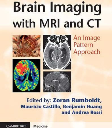 Brain_Imaging_with_MRI_and_CT_An_Image_Pattern_Approach.jpg