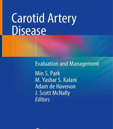 Carotid_Artery_Disease_Evaluation_and_Management.jpg