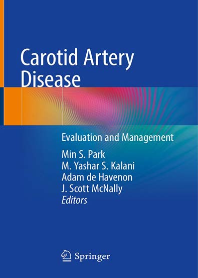 Carotid_Artery_Disease_Evaluation_and_Management.jpg