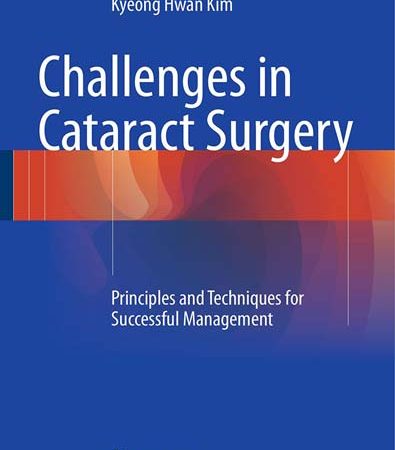 Challenges_in_Cataract_Surgery_Principles_and_Techniques_for_Successful_Management.jpg