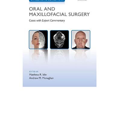 Challenging_Concepts_in_Oral_and_Maxillofacial_Surgery_Cases_with_Expert_Commentary.jpg