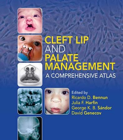 Cleft_lip_and_palate_management_a_comprehensive_atlas.jpg