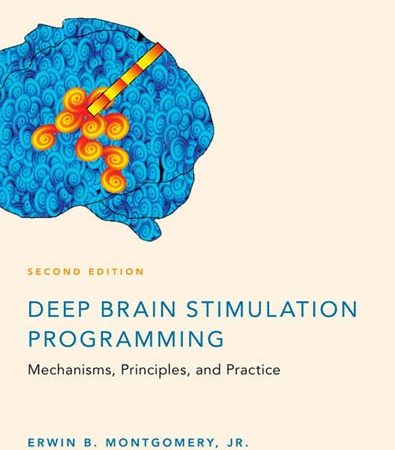 Deep_brain_stimulation_programming_mechanisms_principles_and_practice.jpg