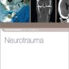 Neurotrauma_NEUROSURGERY_BY_EXAMPLE_1.jpg