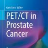 PETCT_in_prostate_cancer.jpg