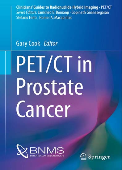 PETCT_in_prostate_cancer.jpg PETCT_in_prostate_cancer.jpg