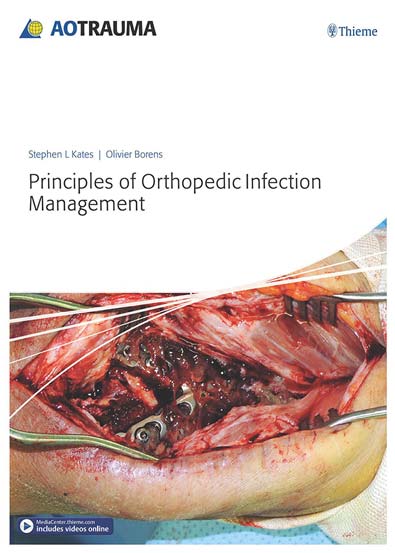 Principles_of_orthopedic_infection_management.jpg