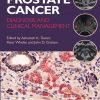 Prostate_Cancer_Diagnosis_and_Clinical_Management.jpg