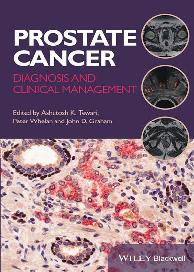Prostate_Cancer_Diagnosis_and_Clinical_Management.jpg