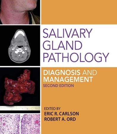 Salivary_gland_pathology_diagnosis_and_management.jpg Salivary_gland_pathology_diagnosis_and_management.jpg