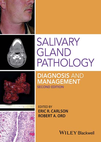 Salivary_gland_pathology_diagnosis_and_management.jpg Salivary_gland_pathology_diagnosis_and_management.jpg