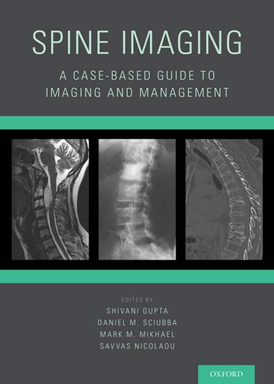Spine_imaging_a_casebased_guide_to_imaging_and_management.jpg