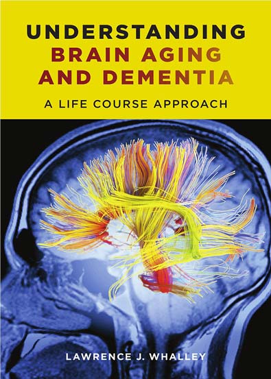 Understanding_Brain_Aging_and_Dementia.jpg Understanding_Brain_Aging_and_Dementia.jpg